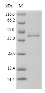 (Tris-Glycine gel) Discontinuous SDS-PAGE (reduced) with 5% enrichment gel and 15% separation gel.