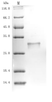 (Tris-Glycine gel) Discontinuous SDS-PAGE (reduced) with 5% enrichment gel and 15% separation gel.
