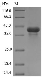 (Tris-Glycine gel) Discontinuous SDS-PAGE (reduced) with 5% enrichment gel and 15% separation gel.