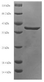 (Tris-Glycine gel) Discontinuous SDS-PAGE (reduced) with 5% enrichment gel and 15% separation gel.