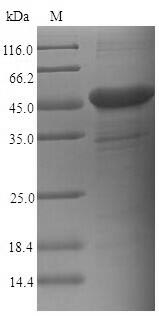 (Tris-Glycine gel) Discontinuous SDS-PAGE (reduced) with 5% enrichment gel and 15% separation gel.