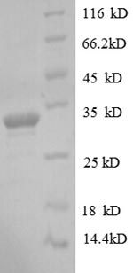 (Tris-Glycine gel) Discontinuous SDS-PAGE (reduced) with 5% enrichment gel and 15% separation gel.