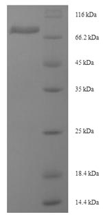 (Tris-Glycine gel) Discontinuous SDS-PAGE (reduced) with 5% enrichment gel and 15% separation gel.