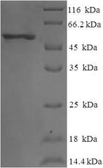 (Tris-Glycine gel) Discontinuous SDS-PAGE (reduced) with 5% enrichment gel and 15% separation gel.