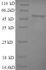 (Tris-Glycine gel) Discontinuous SDS-PAGE (reduced) with 5% enrichment gel and 15% separation gel.