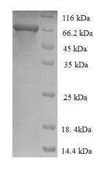 (Tris-Glycine gel) Discontinuous SDS-PAGE (reduced) with 5% enrichment gel and 15% separation gel.