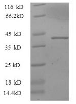 (Tris-Glycine gel) Discontinuous SDS-PAGE (reduced) with 5% enrichment gel and 15% separation gel.