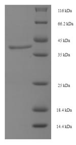 (Tris-Glycine gel) Discontinuous SDS-PAGE (reduced) with 5% enrichment gel and 15% separation gel.