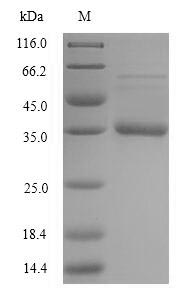 (Tris-Glycine gel) Discontinuous SDS-PAGE (reduced) with 5% enrichment gel and 15% separation gel.