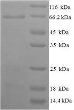 (Tris-Glycine gel) Discontinuous SDS-PAGE (reduced) with 5% enrichment gel and 15% separation gel.