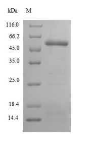 (Tris-Glycine gel) Discontinuous SDS-PAGE (reduced) with 5% enrichment gel and 15% separation gel.
