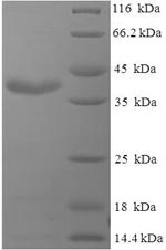 (Tris-Glycine gel) Discontinuous SDS-PAGE (reduced) with 5% enrichment gel and 15% separation gel.