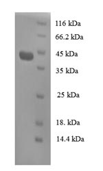 (Tris-Glycine gel) Discontinuous SDS-PAGE (reduced) with 5% enrichment gel and 15% separation gel.