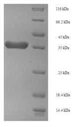 (Tris-Glycine gel) Discontinuous SDS-PAGE (reduced) with 5% enrichment gel and 15% separation gel.
