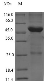 (Tris-Glycine gel) Discontinuous SDS-PAGE (reduced) with 5% enrichment gel and 15% separation gel.