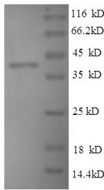 (Tris-Glycine gel) Discontinuous SDS-PAGE (reduced) with 5% enrichment gel and 15% separation gel.