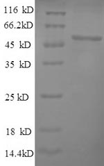 (Tris-Glycine gel) Discontinuous SDS-PAGE (reduced) with 5% enrichment gel and 15% separation gel.
