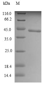 (Tris-Glycine gel) Discontinuous SDS-PAGE (reduced) with 5% enrichment gel and 15% separation gel.