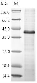 Discontinuous SDS-PAGE (reduced) with 5% enrichment gel and 15% separation gel.