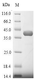 (Tris-Glycine gel) Discontinuous SDS-PAGE (reduced) with 5% enrichment gel and 15% separation gel.