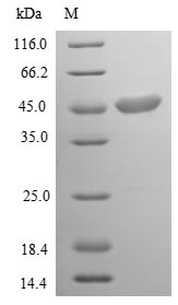 (Tris-Glycine gel) Discontinuous SDS-PAGE (reduced) with 5% enrichment gel and 15% separation gel.