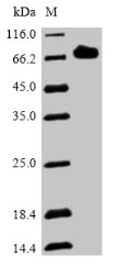 (Tris-Glycine gel) Discontinuous SDS-PAGE (reduced) with 5% enrichment gel and 15% separation gel.