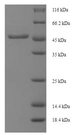 (Tris-Glycine gel) Discontinuous SDS-PAGE (reduced) with 5% enrichment gel and 15% separation gel.