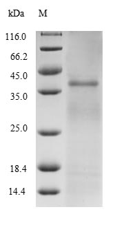 (Tris-Glycine gel) Discontinuous SDS-PAGE (reduced) with 5% enrichment gel and 15% separation gel.
