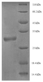 (Tris-Glycine gel) Discontinuous SDS-PAGE (reduced) with 5% enrichment gel and 15% separation gel.