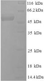 (Tris-Glycine gel) Discontinuous SDS-PAGE (reduced) with 5% enrichment gel and 15% separation gel.