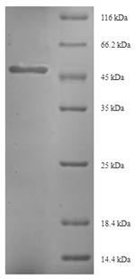 (Tris-Glycine gel) Discontinuous SDS-PAGE (reduced) with 5% enrichment gel and 15% separation gel.