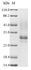 (Tris-Glycine gel) Discontinuous SDS-PAGE (reduced) with 5% enrichment gel and 15% separation gel.