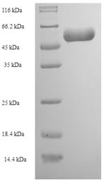(Tris-Glycine gel) Discontinuous SDS-PAGE (reduced) with 5% enrichment gel and 15% separation gel.