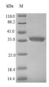 (Tris-Glycine gel) Discontinuous SDS-PAGE (reduced) with 5% enrichment gel and 15% separation gel.