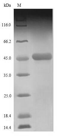 (Tris-Glycine gel) Discontinuous SDS-PAGE (reduced) with 5% enrichment gel and 15% separation gel.