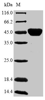 (Tris-Glycine gel) Discontinuous SDS-PAGE (reduced) with 5% enrichment gel and 15% separation gel.