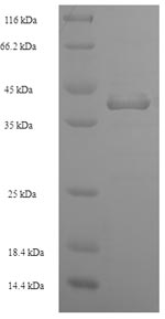 (Tris-Glycine gel) Discontinuous SDS-PAGE (reduced) with 5% enrichment gel and 15% separation gel.