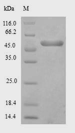 (Tris-Glycine gel) Discontinuous SDS-PAGE (reduced) with 5% enrichment gel and 15% separation gel.