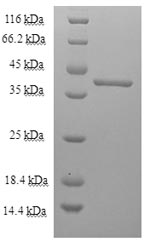 (Tris-Glycine gel) Discontinuous SDS-PAGE (reduced) with 5% enrichment gel and 15% separation gel.