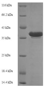 (Tris-Glycine gel) Discontinuous SDS-PAGE (reduced) with 5% enrichment gel and 15% separation gel.