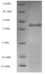 (Tris-Glycine gel) Discontinuous SDS-PAGE (reduced) with 5% enrichment gel and 15% separation gel.