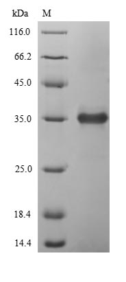 (Tris-Glycine gel) Discontinuous SDS-PAGE (reduced) with 5% enrichment gel and 15% separation gel.