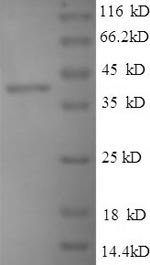 (Tris-Glycine gel) Discontinuous SDS-PAGE (reduced) with 5% enrichment gel and 15% separation gel.