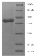 (Tris-Glycine gel) Discontinuous SDS-PAGE (reduced) with 5% enrichment gel and 15% separation gel.