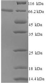 (Tris-Glycine gel) Discontinuous SDS-PAGE (reduced) with 5% enrichment gel and 15% separation gel.
