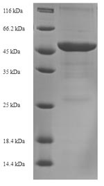 (Tris-Glycine gel) Discontinuous SDS-PAGE (reduced) with 5% enrichment gel and 15% separation gel.