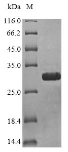 (Tris-Glycine gel) Discontinuous SDS-PAGE (reduced) with 5% enrichment gel and 15% separation gel.