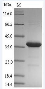 (Tris-Glycine gel) Discontinuous SDS-PAGE (reduced) with 5% enrichment gel and 15% separation gel.