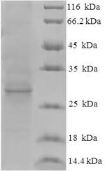 (Tris-Glycine gel) Discontinuous SDS-PAGE (reduced) with 5% enrichment gel and 15% separation gel.