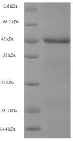 (Tris-Glycine gel) Discontinuous SDS-PAGE (reduced) with 5% enrichment gel and 15% separation gel.